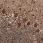 Atlas Antibodies Anti-UCHL1 Antibody