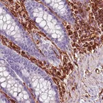 Atlas Antibodies Anti-VIM Antibody