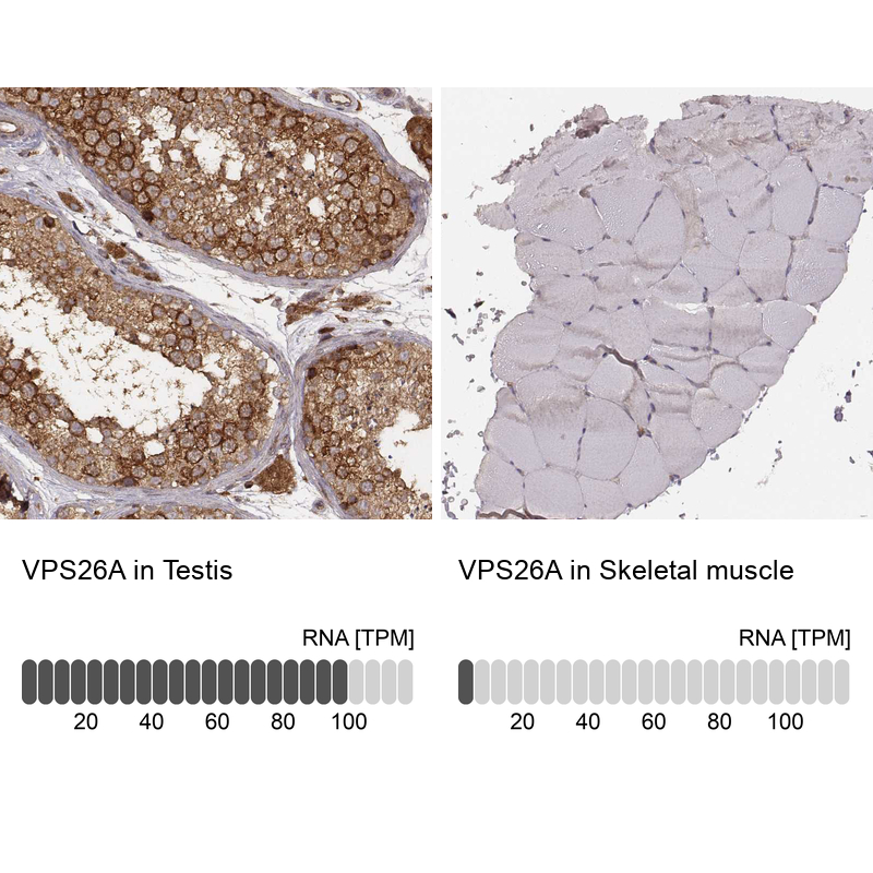 Atlas Antibodies Anti-VPS26A Antibody