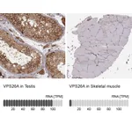 Atlas Antibodies Anti-VPS26A Antibody
