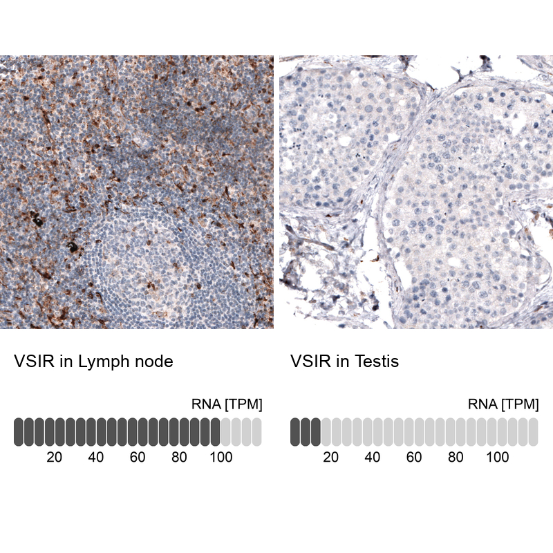 Atlas Antibodies Anti-VSIR Antibody