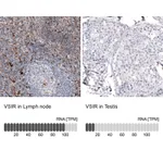 Atlas Antibodies Anti-VSIR Antibody