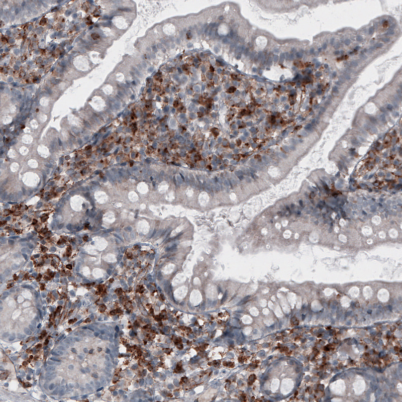 Atlas Antibodies Anti-VSIR Antibody