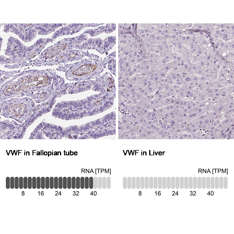 Atlas Antibodies Anti-VWF Antibody