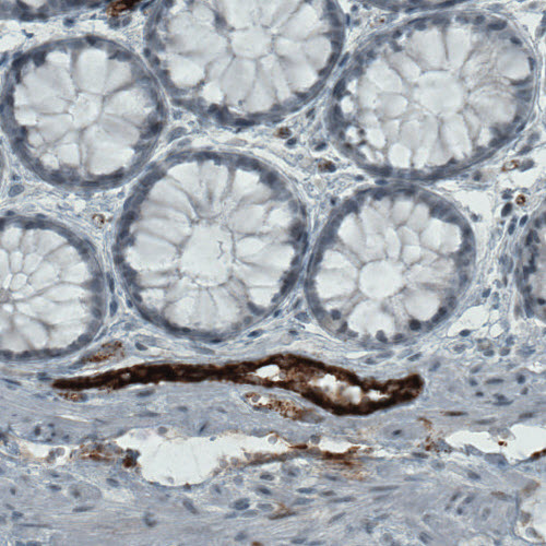 Atlas Antibodies Anti-VWF Antibody