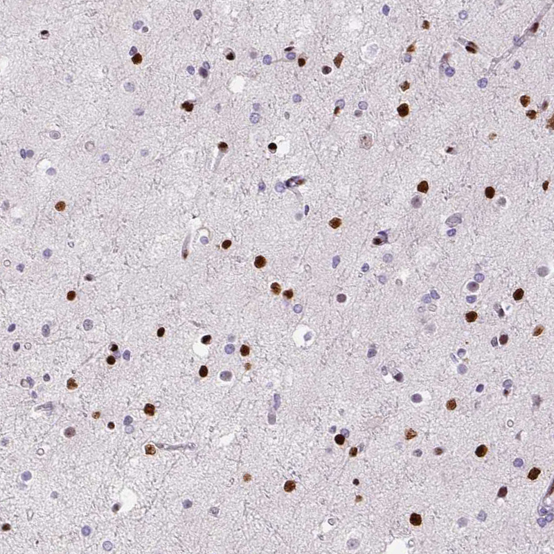 Atlas Antibodies Anti-ZEB1 Antibody