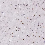 Atlas Antibodies Anti-ZEB1 Antibody
