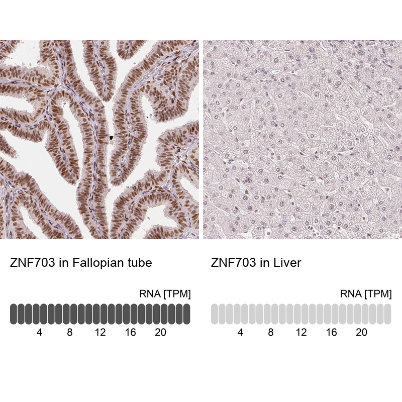 Atlas Antibodies Anti-ZNF703 Antibody