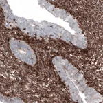 Atlas Antibodies Anti-ZYX Antibody
