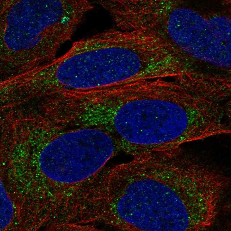 Atlas Antibodies Anti-A4GALT Antibody