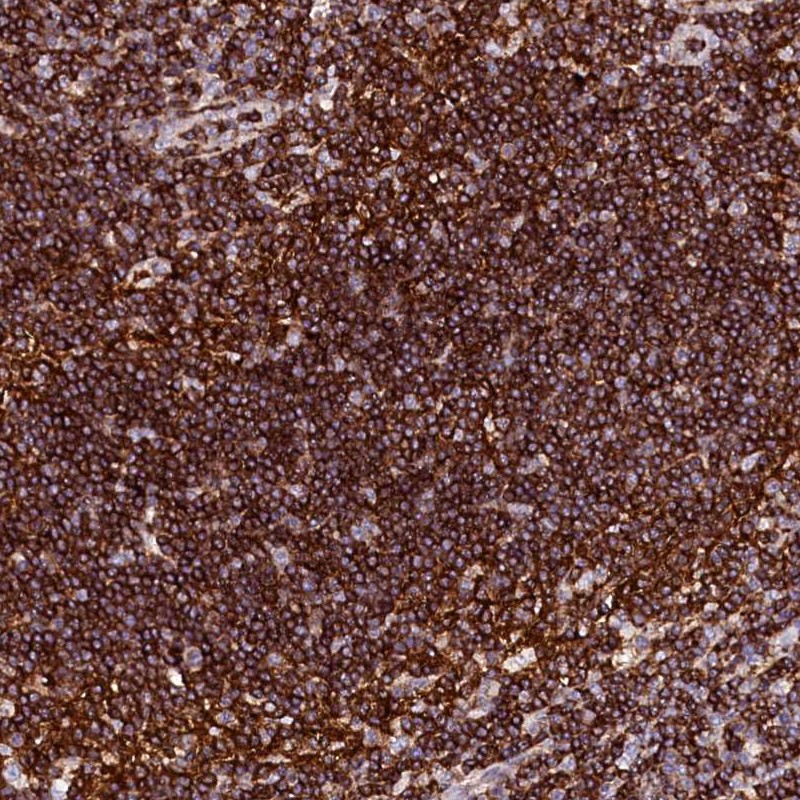 Atlas Antibodies Anti-AAAS Antibody