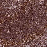 Atlas Antibodies Anti-AAAS Antibody
