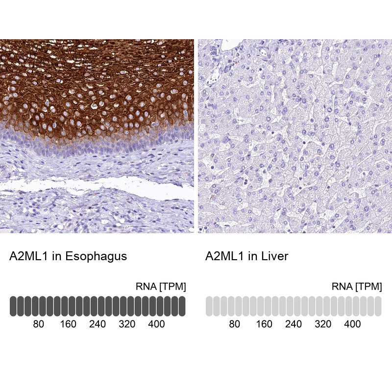 Atlas Antibodies Anti-A2ML1 Antibody