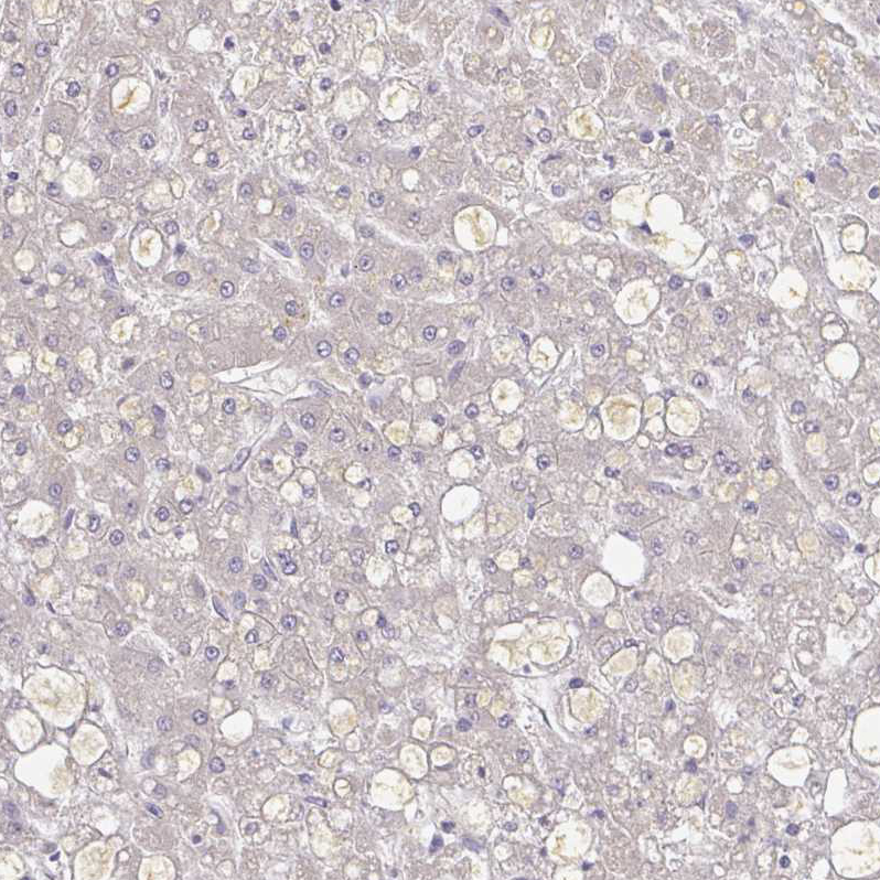 Atlas Antibodies Anti-A1BG Antibody