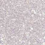 Atlas Antibodies Anti-A1BG Antibody