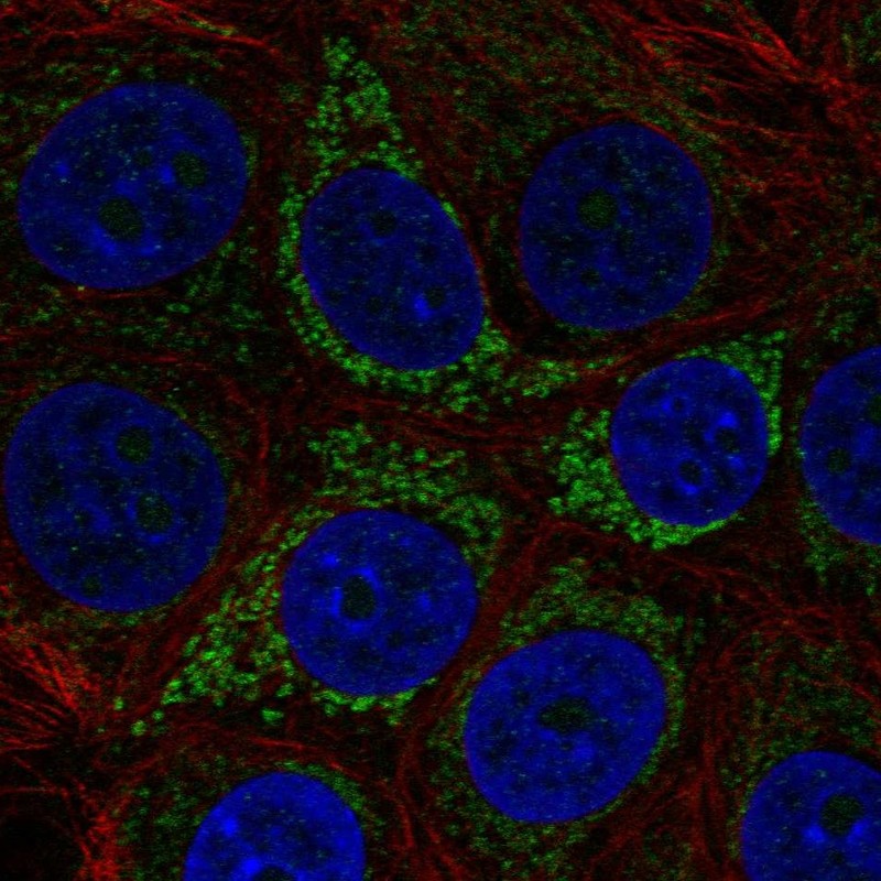 Atlas Antibodies Anti-A4GALT Antibody