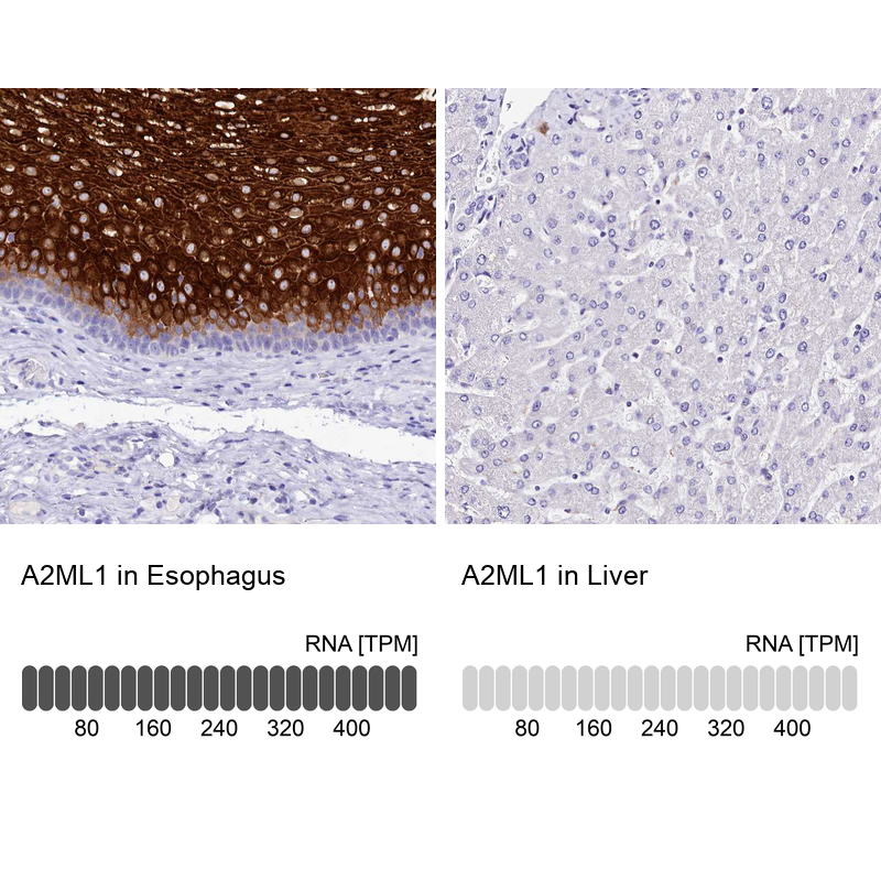 Atlas Antibodies Anti-A2ML1 Antibody