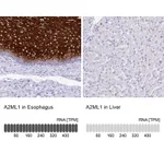 Atlas Antibodies Anti-A2ML1 Antibody