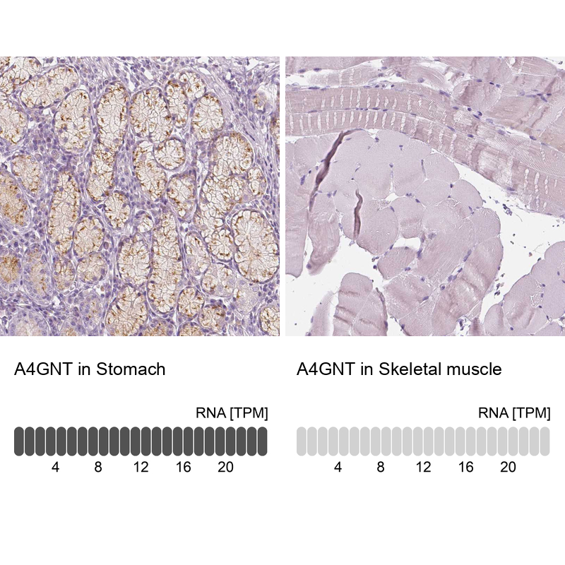Atlas Antibodies Anti-A4GNT Antibody