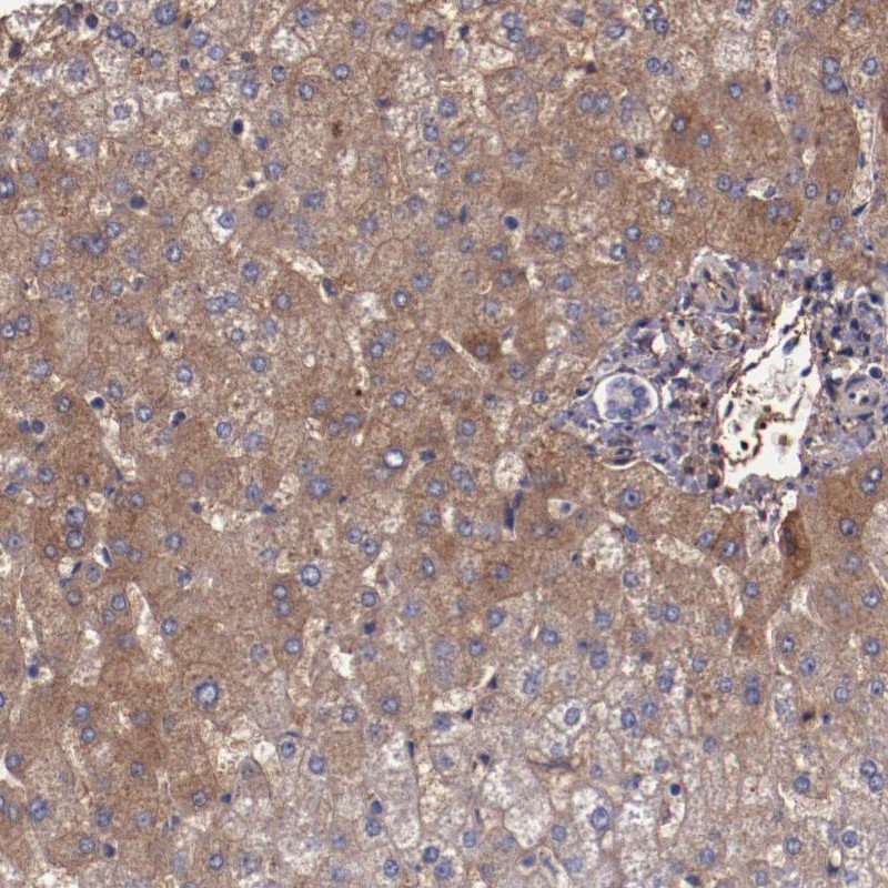 Atlas Antibodies Anti-A2M Antibody