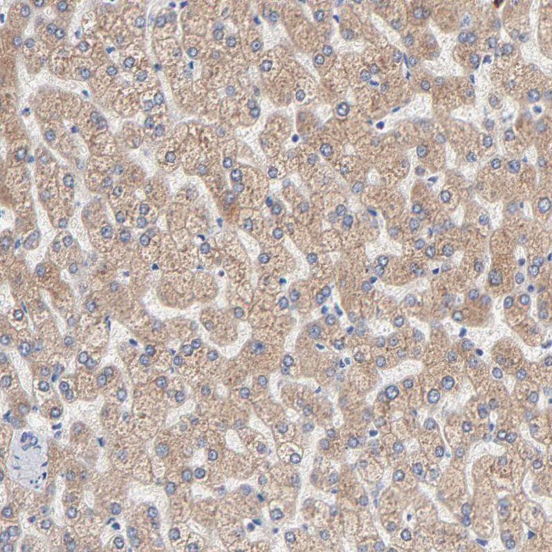 Atlas Antibodies Anti-AADAC Antibody