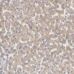 Atlas Antibodies Anti-AADAC Antibody