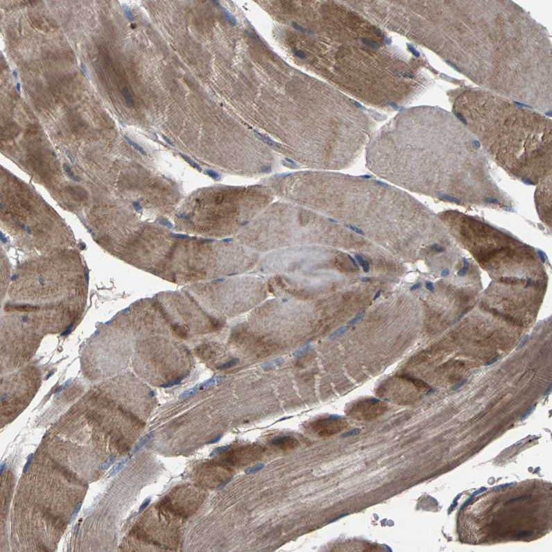 Atlas Antibodies Anti-AAED1 Antibody