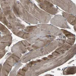Atlas Antibodies Anti-AAED1 Antibody