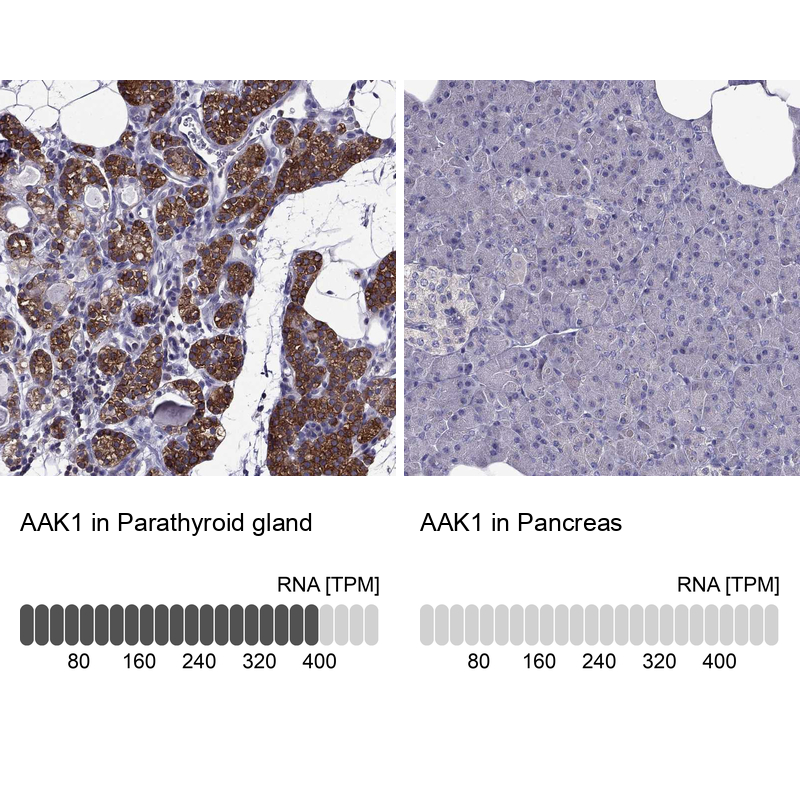 Atlas Antibodies Anti-AAK1 Antibody