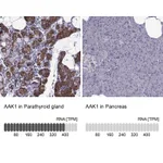 Atlas Antibodies Anti-AAK1 Antibody