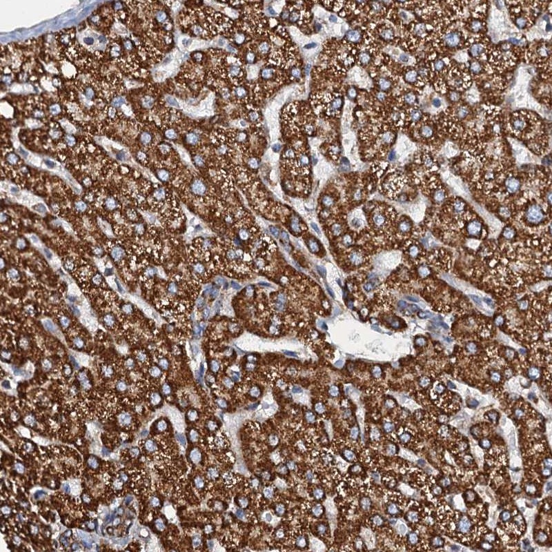 Atlas Antibodies Anti-AAGAB Antibody