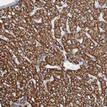 Atlas Antibodies Anti-AAGAB Antibody