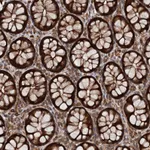 Atlas Antibodies Anti-AAGAB Antibody