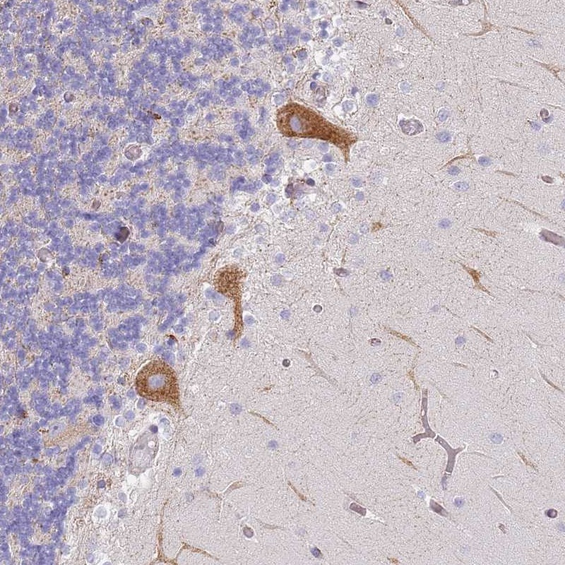 Atlas Antibodies Anti-AADACL4 Antibody