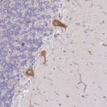 Atlas Antibodies Anti-AADACL4 Antibody