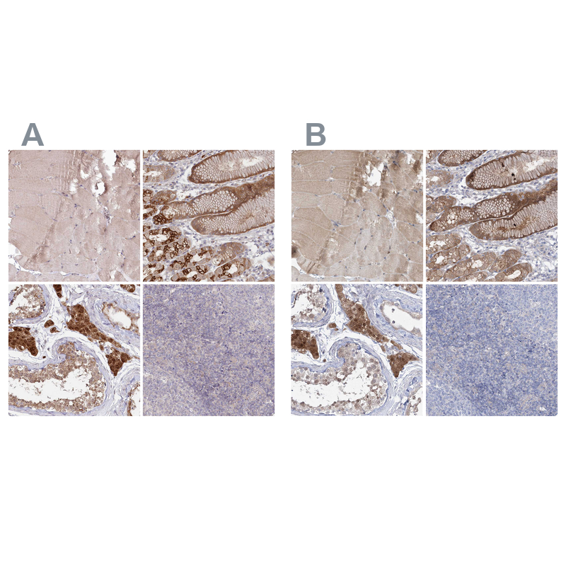 Atlas Antibodies Anti-AAMDC Antibody