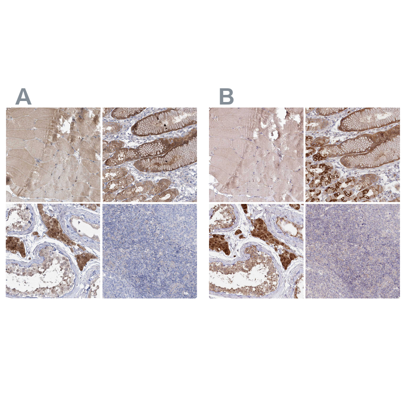 Atlas Antibodies Anti-AAMDC Antibody