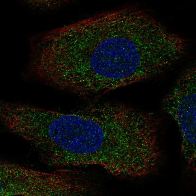 Atlas Antibodies Anti-AANAT Antibody