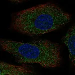 Atlas Antibodies Anti-AANAT Antibody