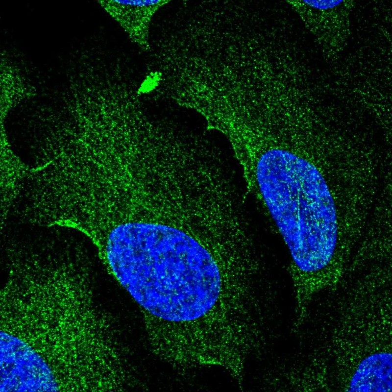 Atlas Antibodies Anti-AAMP Antibody