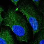 Atlas Antibodies Anti-AAMP Antibody