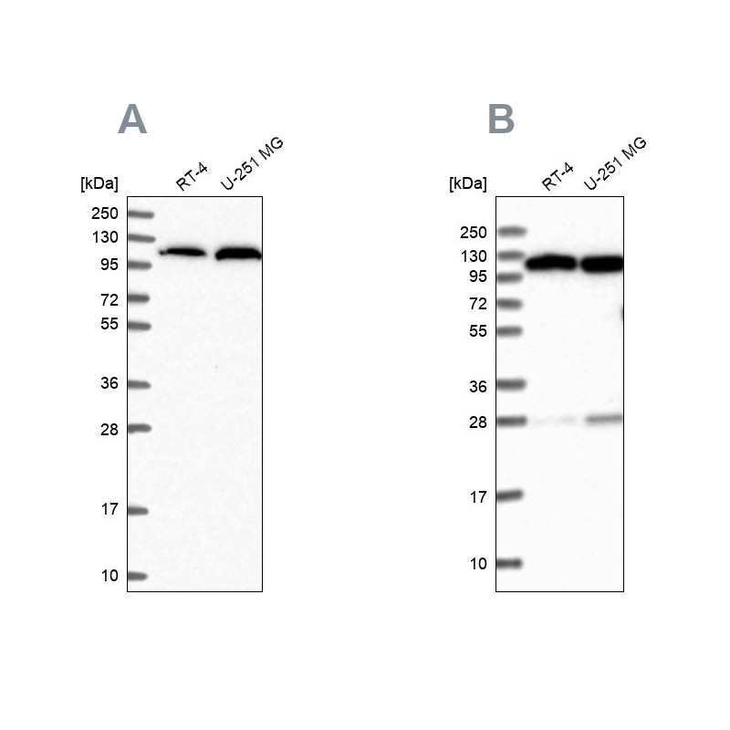 Atlas Antibodies Anti-AARS Antibody