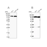 Atlas Antibodies Anti-AARS Antibody