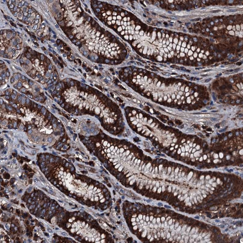 Atlas Antibodies Anti-AARS Antibody