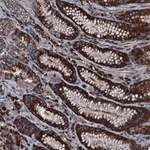 Atlas Antibodies Anti-AARS Antibody