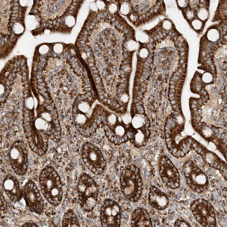 Atlas Antibodies Anti-AARS2 Antibody