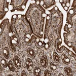 Atlas Antibodies Anti-AARS2 Antibody