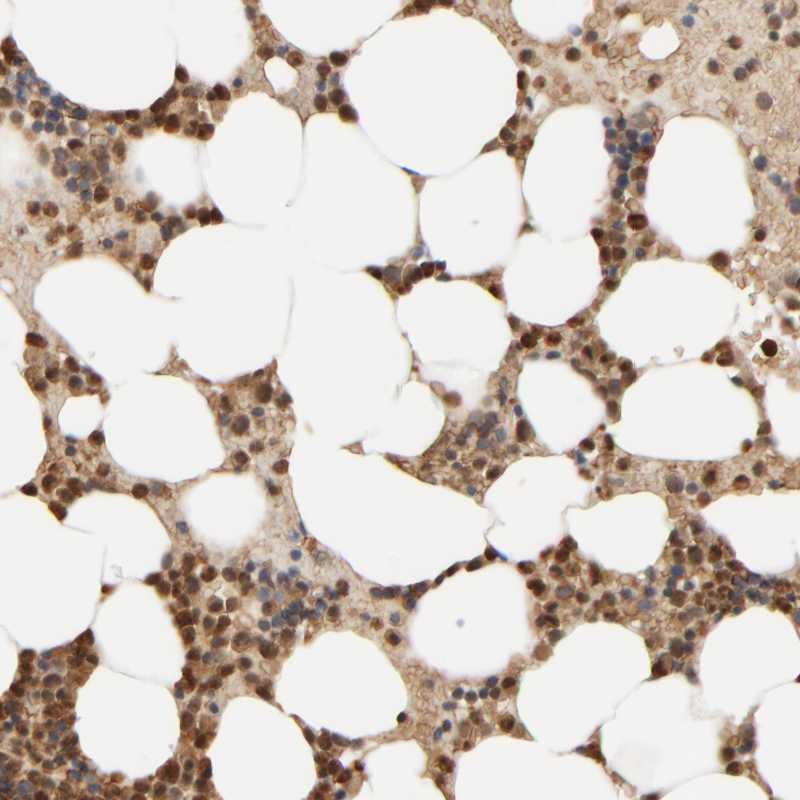 Atlas Antibodies Anti-AARSD1 Antibody