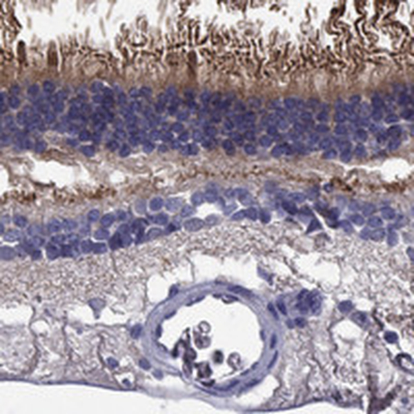 Atlas Antibodies Anti-ABCA4 Antibody