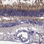 Atlas Antibodies Anti-ABCA4 Antibody